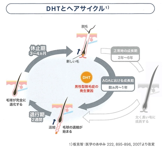 DHTとヘアサイクルのイメージ図