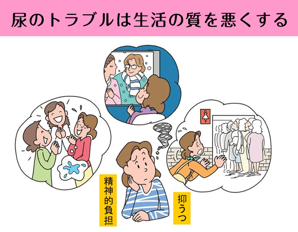 過活動膀胱と神経因性膀胱(低活動膀胱)の違い