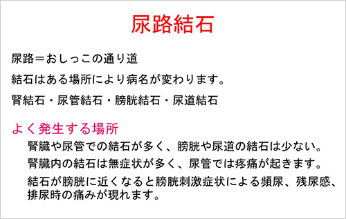 尿路結石